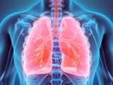 IA lesions pulmonaires