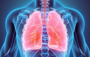 IA lesions pulmonaires