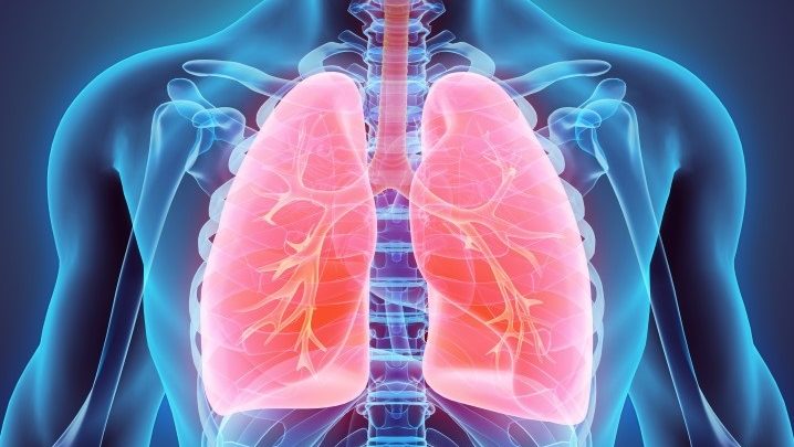 Lésions pulmonaires : une IA peut les dénicher !