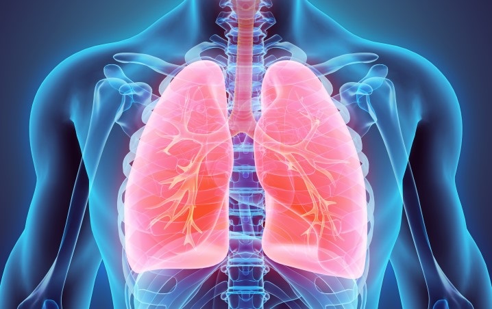 IA lesions pulmonaires